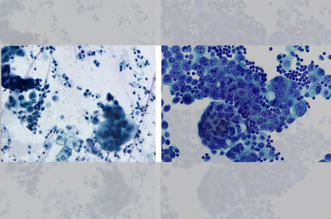A great cytology diagnosis starts with a good image.