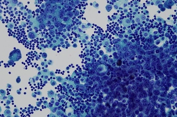 A great cytology diagnosis starts with a good image.