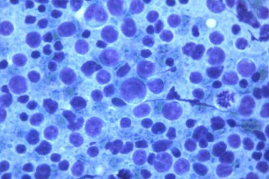A Great Cytology Diagnosis Starts With a Good Image