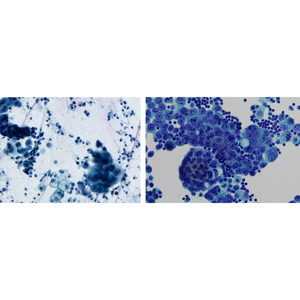 CellDetect