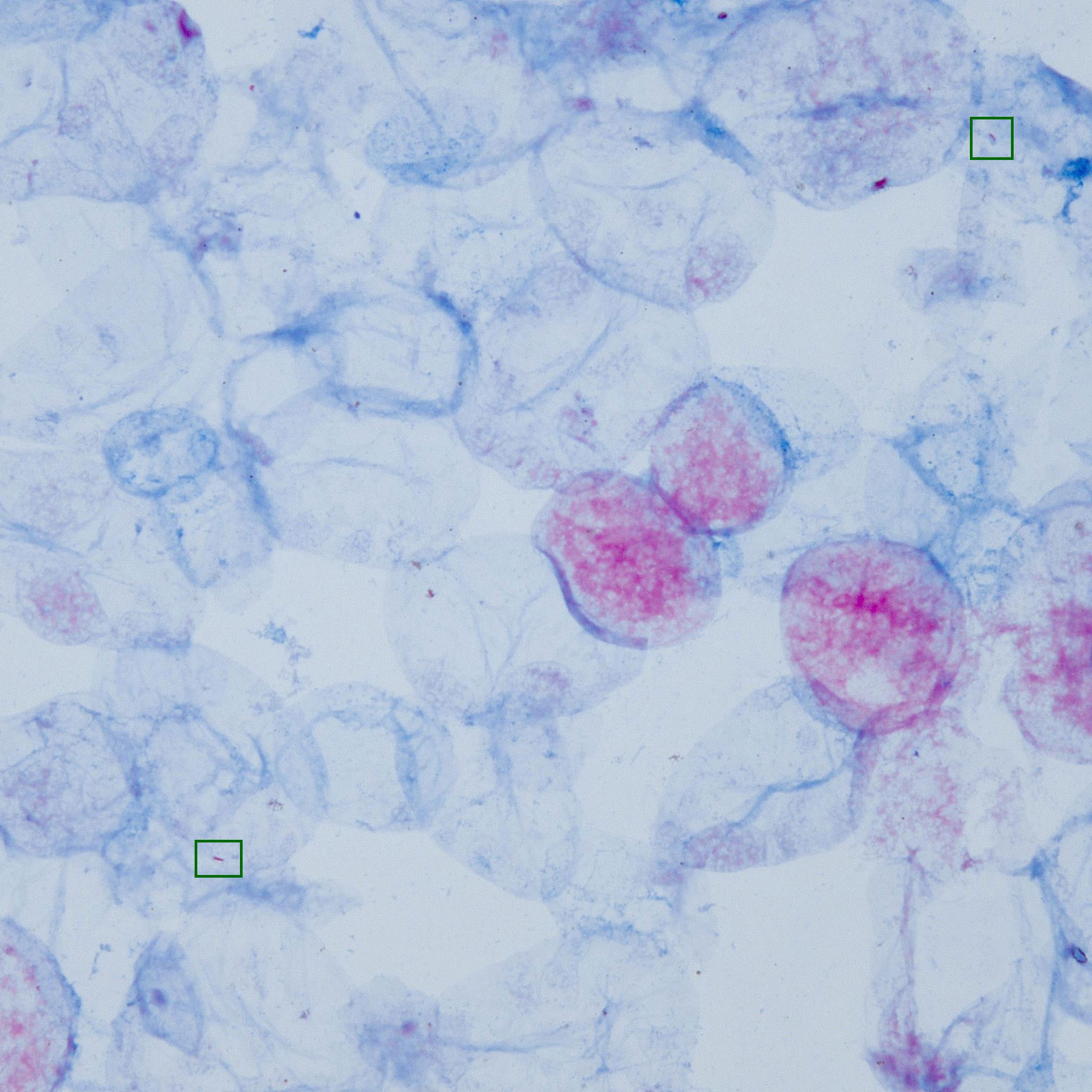 Tuberculosis AFS Images Database